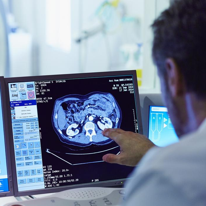 CT scan medical equipment